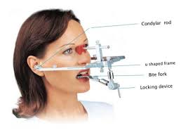 <p>facebow</p>