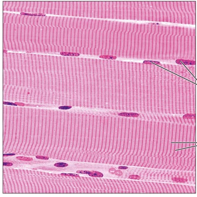 <p>What tissue is depicted in this image (there are striations and multiple nuclei present)</p><p>A. Cardiac muscle</p><p>B. Smooth muscle</p><p>C. Skeletal muscle</p><p>D. Salmon fillet</p>