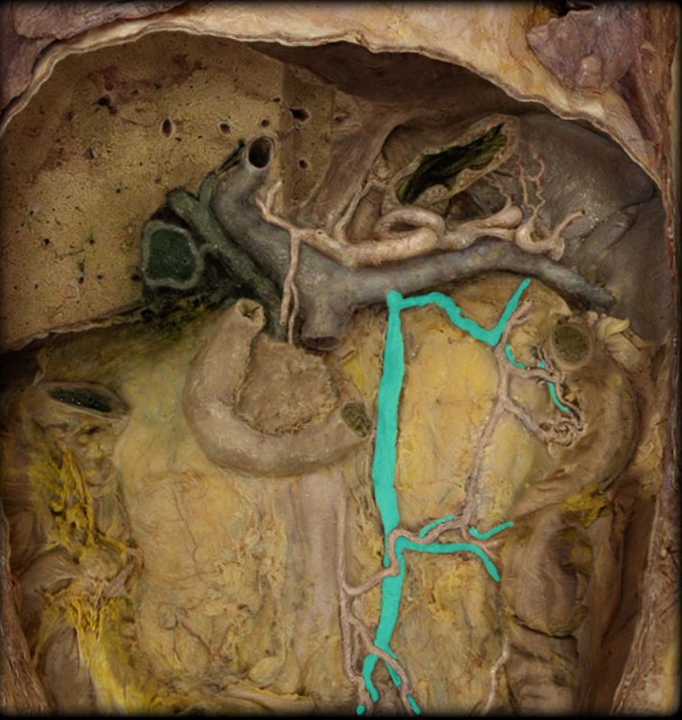 <p>Inferior mesenteric v. and tributaries</p>