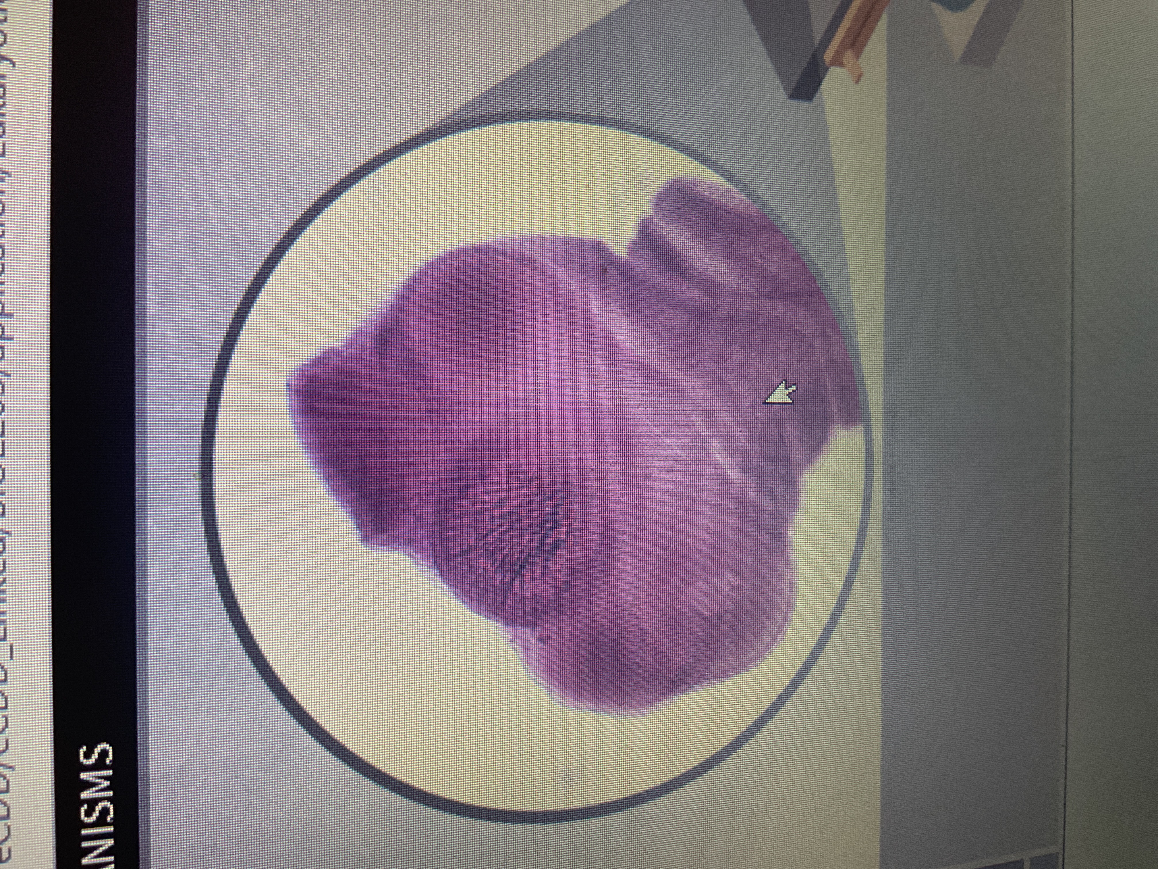 <p>Helminth</p><p>pork tapeworm</p><p>raw and undercooked meat</p>