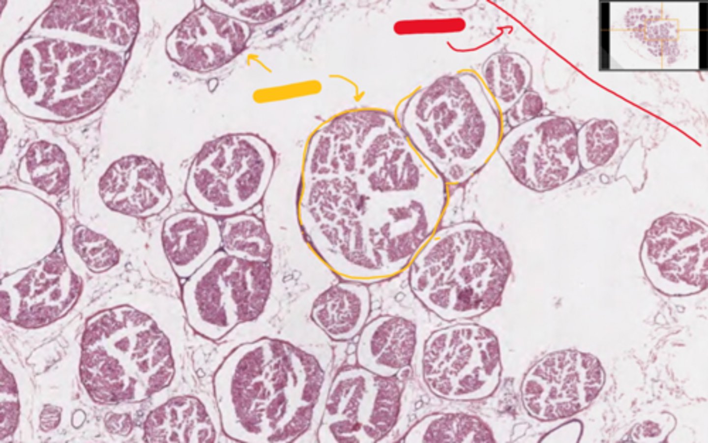 <p>yellow</p><p>(nerve in cross section)</p>