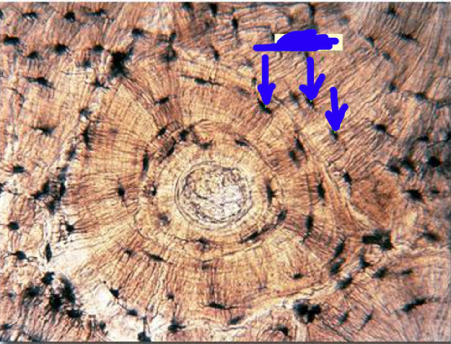 <p>a small cavity within the bone matrix, containing an osteocyte</p>