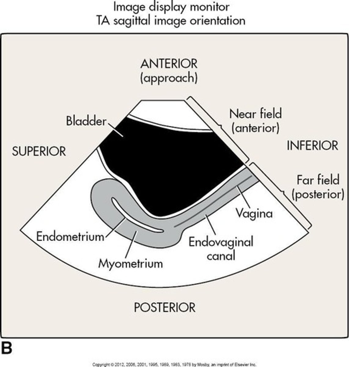 <p>External ultrasound scanning across the abdomen.</p>