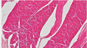<p>BQ:Is this healthy and what type of tissue is this?</p>
