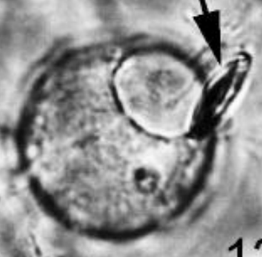 <p>lid-like cap on zoosporangium</p>