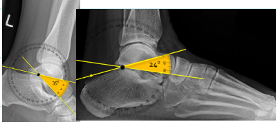 <p>Q what is the name of this measurement? and what is the average + range?</p>