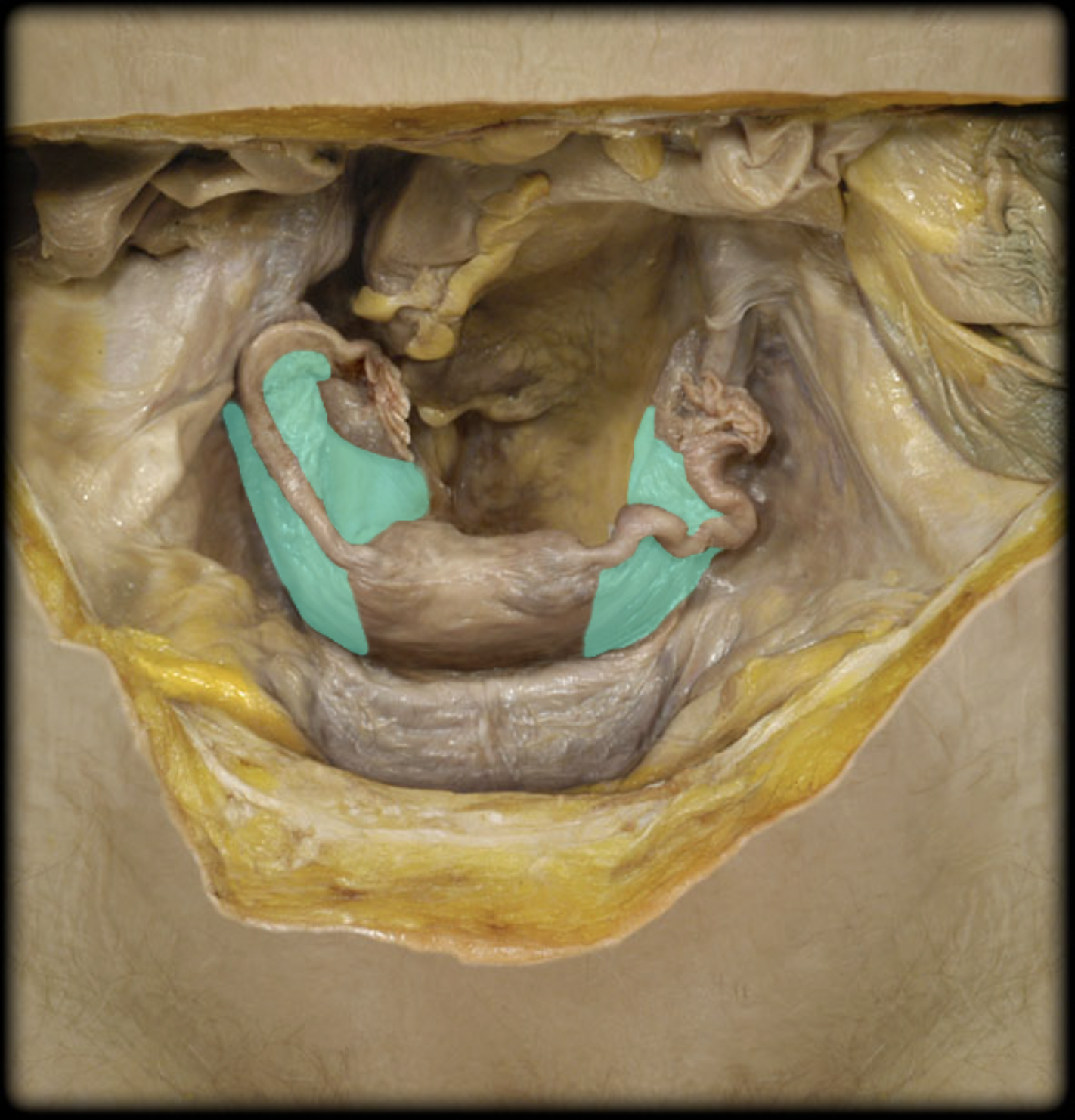 <p>What structure is shown?</p>