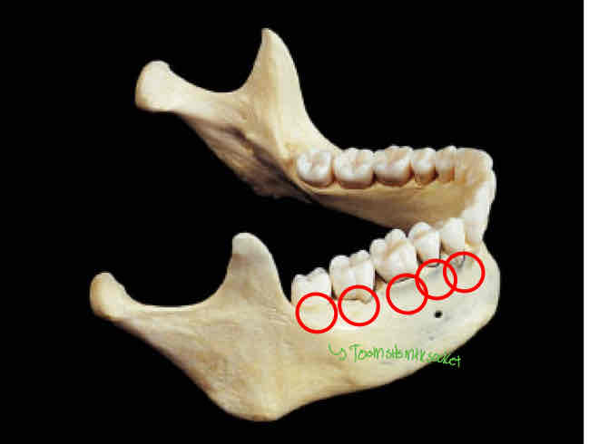 <p>Identify this </p>
