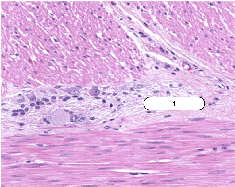 <p>Identify the structure labeled #1</p>