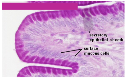<p>Simple Columnar Epithelial Tissue. Dark Nuclei at edge, free surface passageway at center, big goblets therefore produces GOBS of mucus</p>
