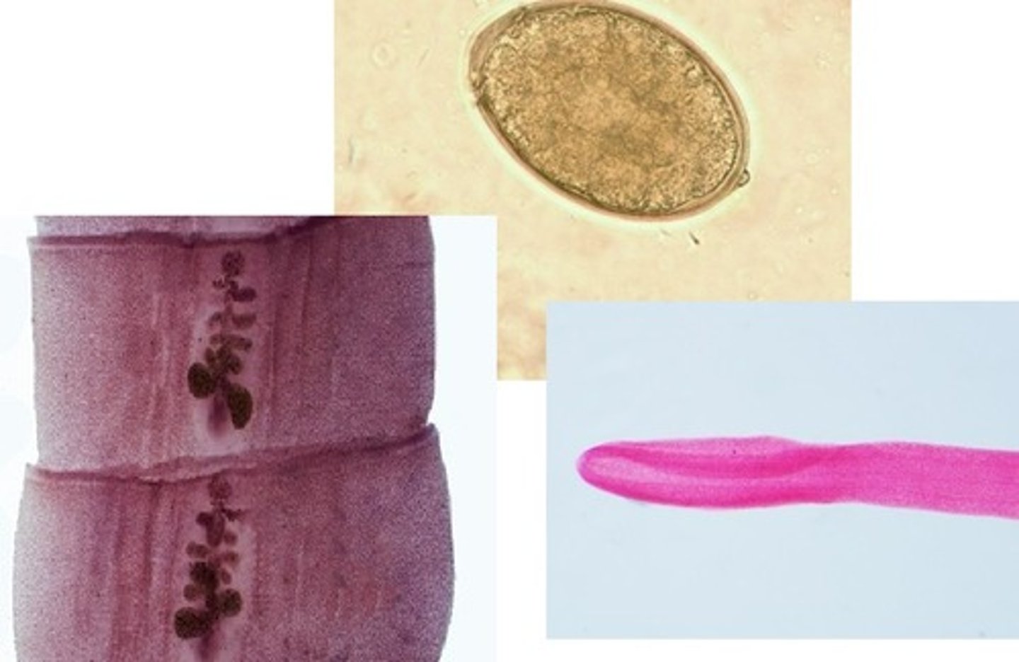 <p>• Eggs smooth with</p><p>shoulderless</p><p>operculum and</p><p>small knob</p><p>o Around 60 microns</p><p>• Worm</p><p>o Scolex is almond-</p><p>shaped with 2</p><p>sucking grooves</p><p>o Proglottids wider</p><p>than long</p>