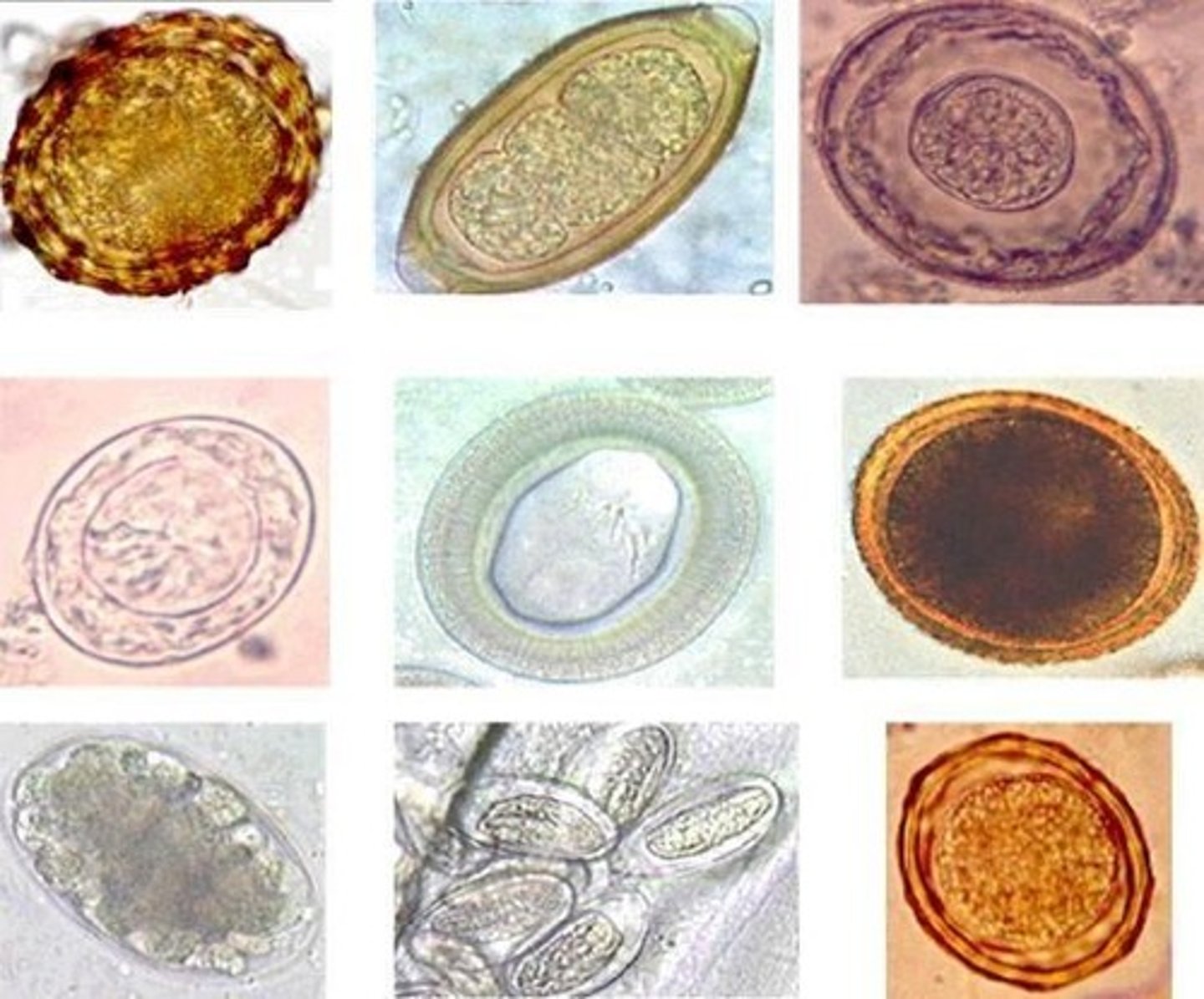 <p>Multicellular animal parasites, including flatworms and roundworms.</p>