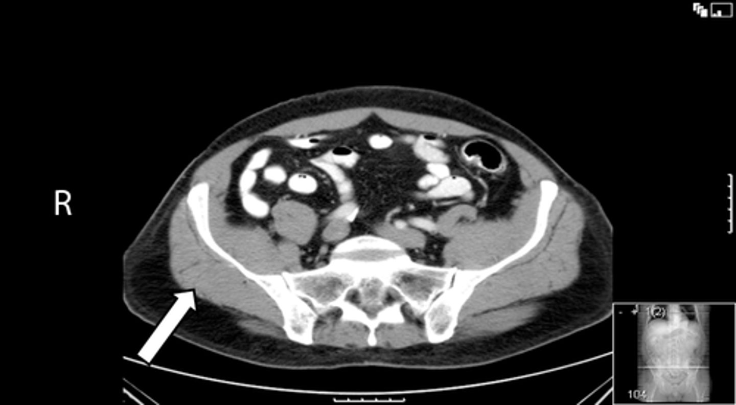 <p>What is indicated in the image?</p>