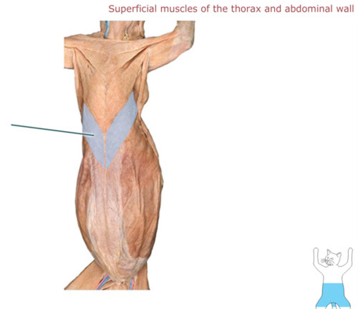 <p>what muscle is highlighted?</p>