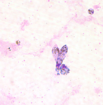 <p>Dr. Vicente Y. Belizario Jr.</p>