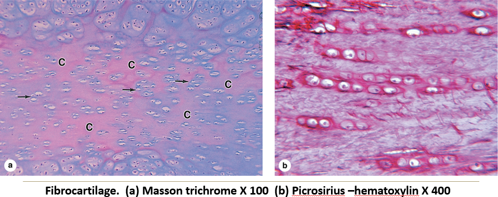 <p>Fibrocartilage</p>