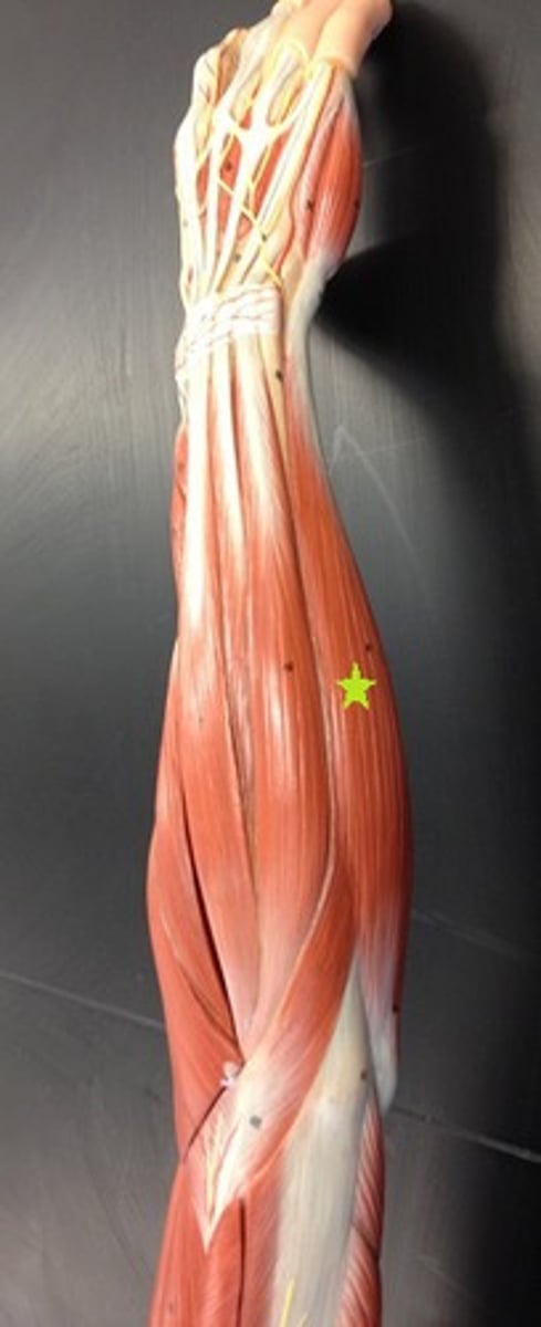 <p>Flexes and adducts hand</p>