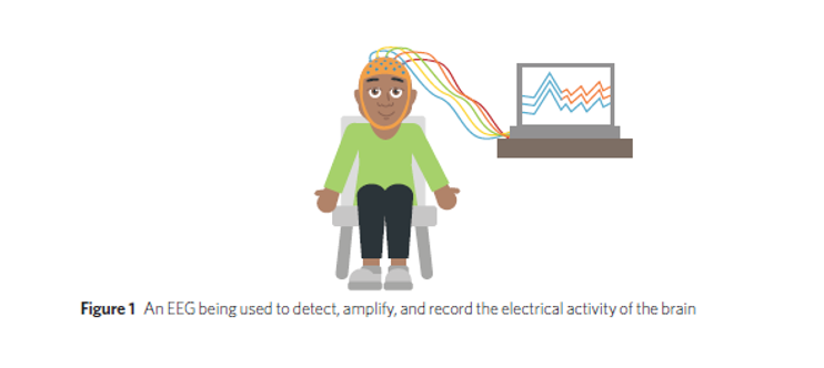 <ul><li><p>It detects, amplifies, and records the electrical activity of the brain</p></li></ul><p></p>