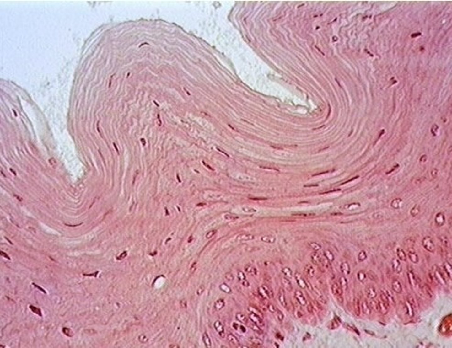 <p>deeper layer of esophagus</p>