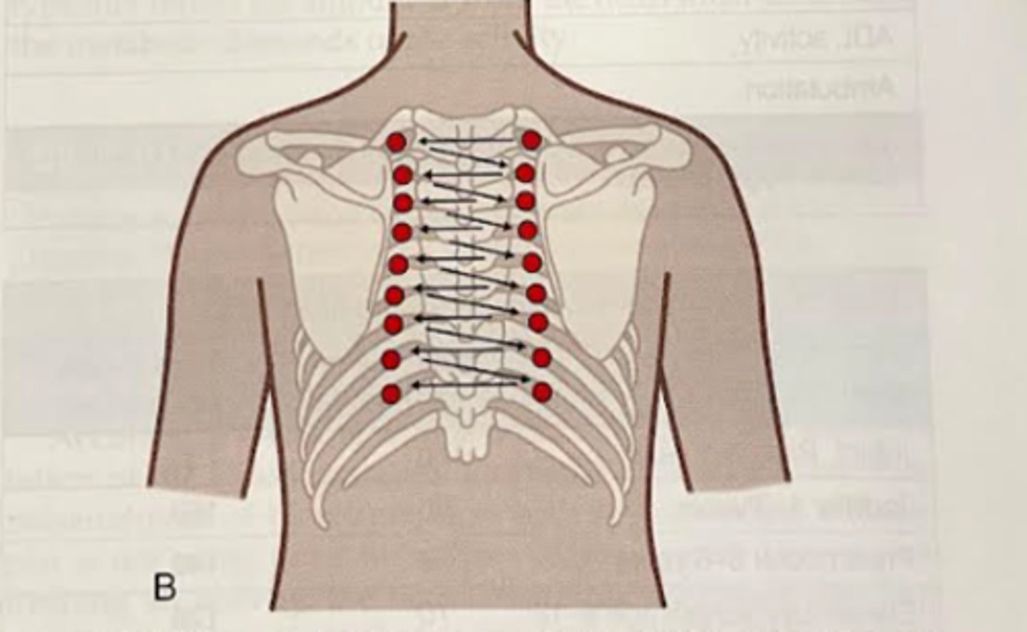 <p>Systematic approach, starting at the level of T1 and progressing down through each intercostal space.<br>-Tap 3 consecutive blows before moving on and always compare side to side.</p>