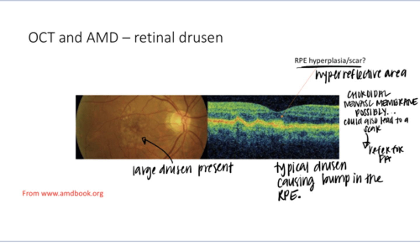 <p>What are the bumps in the RPE?</p>
