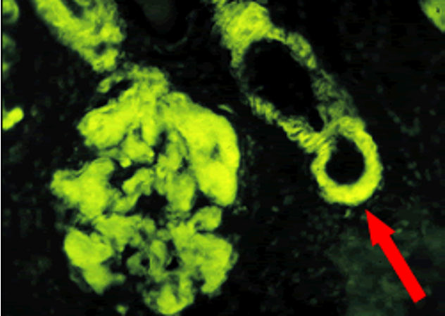 term image