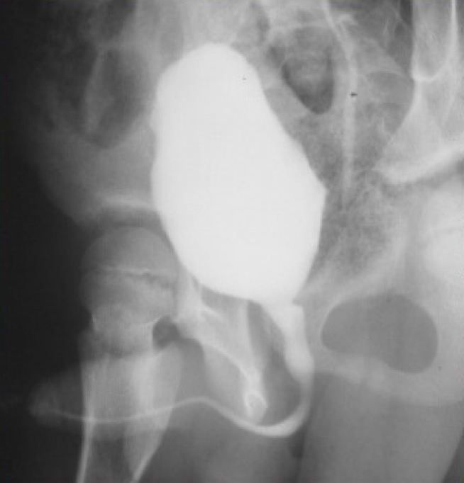<p>What is this X-ray demonstrating?</p>