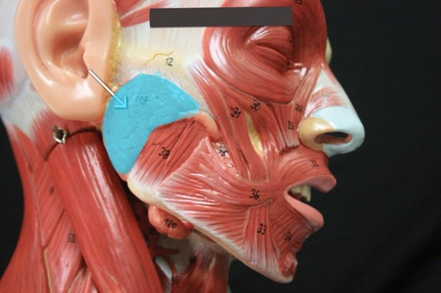 <p>Next to masseter</p>