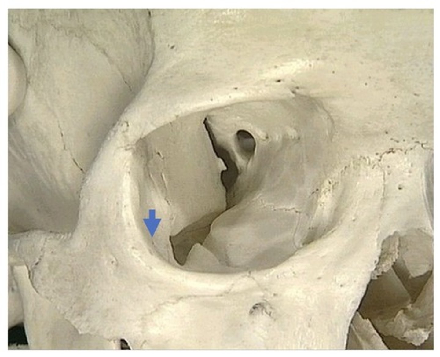 <p>1. In zygomatic bone, within the orbit</p><p>2. There are 2 more small foramen like this</p>