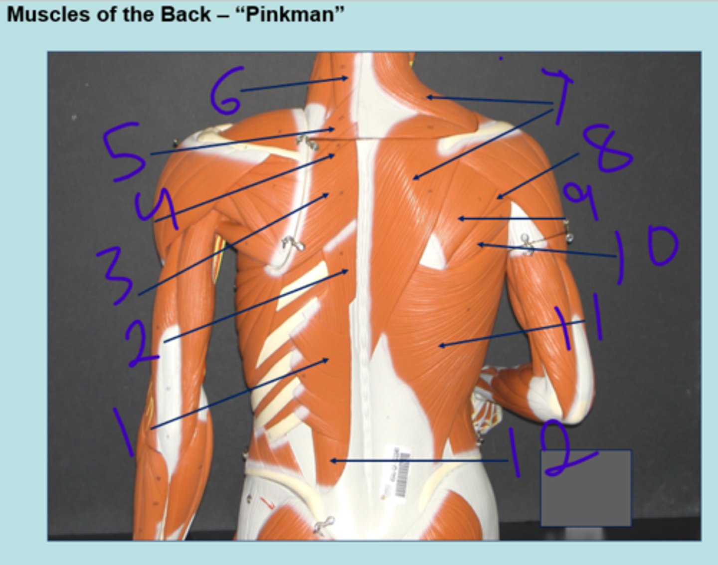<p>muscles of the back - #11</p>