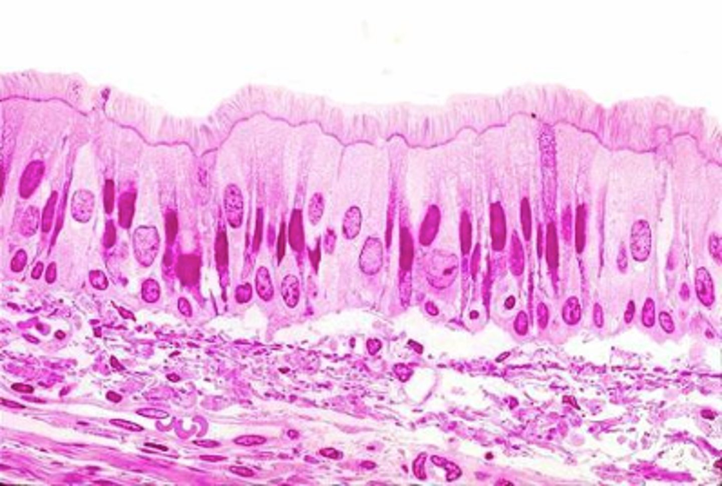 <p>ID the epithelium:</p>