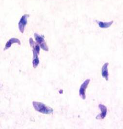 <p><strong>Identify the parasite (Genus, species, and stage).</strong></p><div data-type="horizontalRule"><hr></div><p><strong>Mention the resting form of this parasite.</strong></p><div data-type="horizontalRule"><hr></div><p><strong>Mention two other stages of this parasite.</strong></p><div data-type="horizontalRule"><hr></div><p><strong>Mention two morphological characters of this stage.</strong></p><div data-type="horizontalRule"><hr></div><p><strong>Identify samples used for detection of this parasitic stage.</strong></p><div data-type="horizontalRule"><hr></div><p><strong>List two stains used for detecting this parasite.</strong></p>