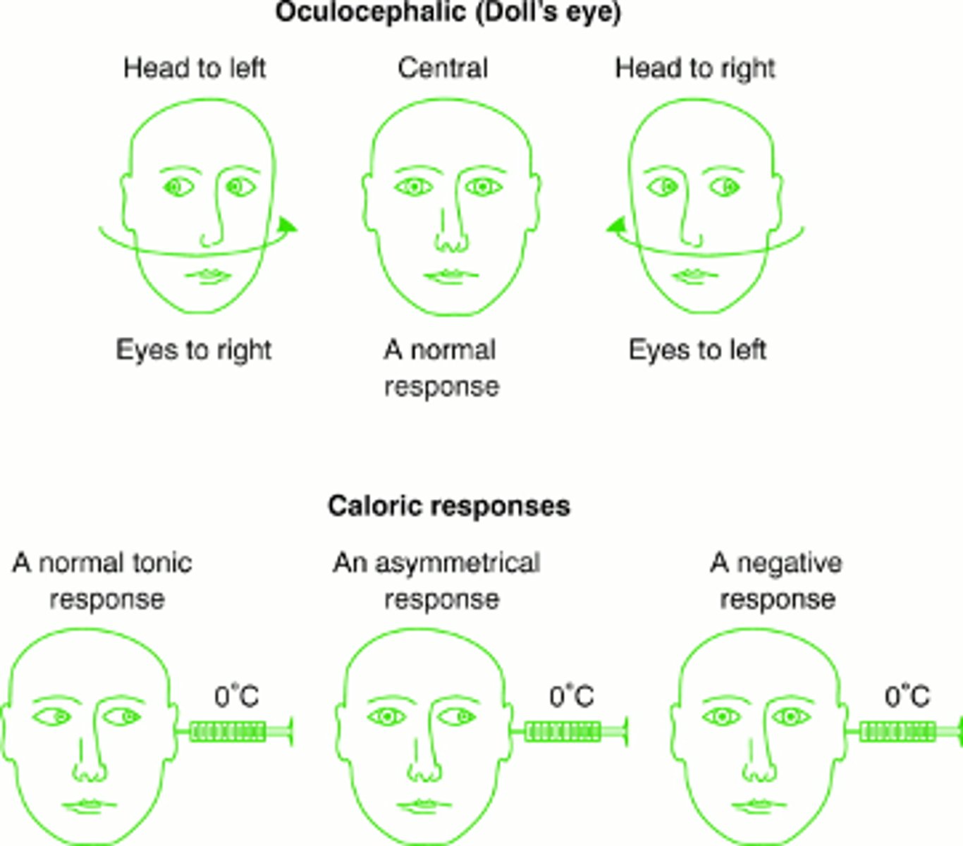 <p>doll's eyes movement assessing brainstem functioning</p>