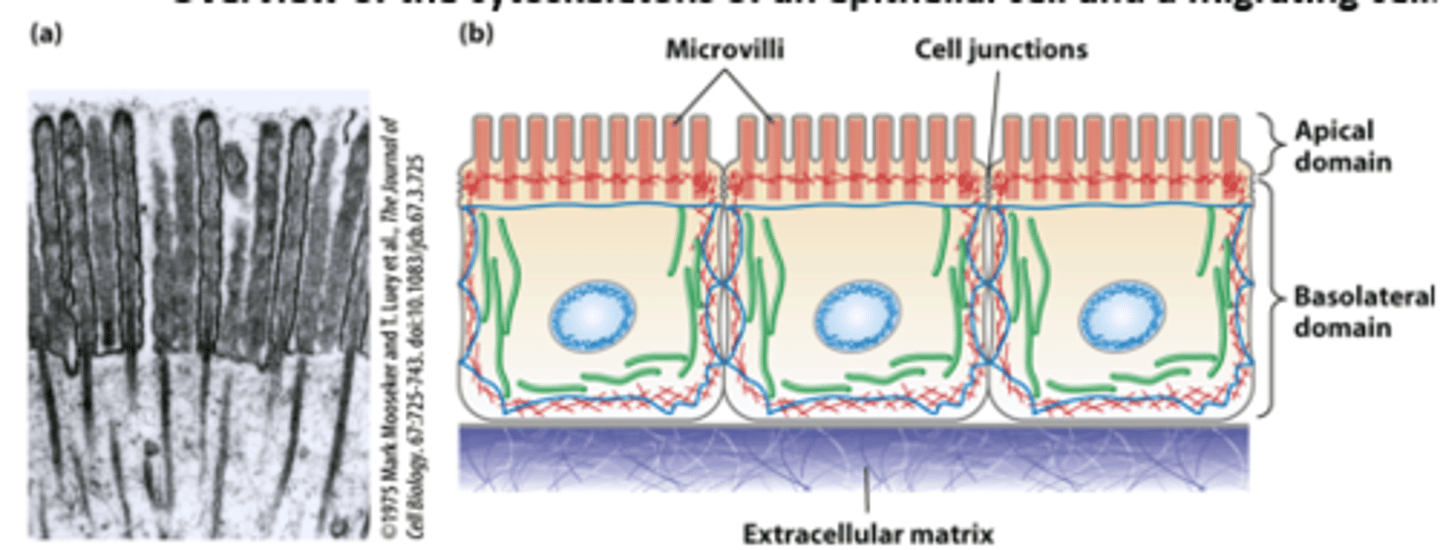 <p>Epithelial cells lining the intestine: The highly polarized intestinal epithelial cell structure, with distinct apical and basolateral domains, is supported by the cytoskeleton - core bundles of _________ _______________ provide support to the intestinal epithelial cell apical microvilli (TEM of thin section)</p>