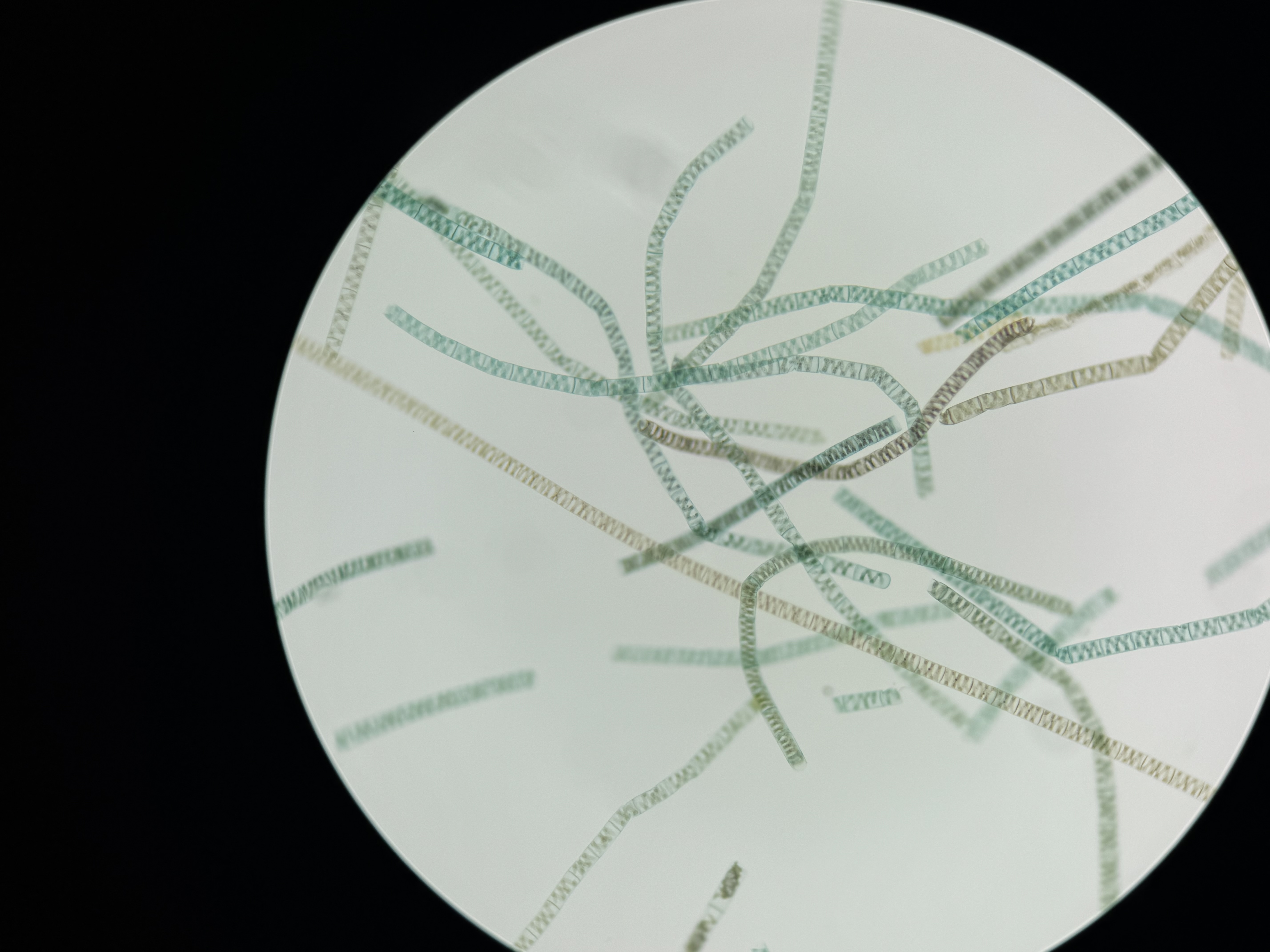 <p>Spirogyra</p>