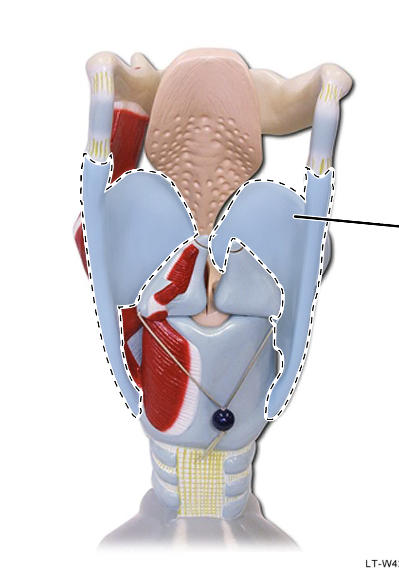 <p>What is this?</p>