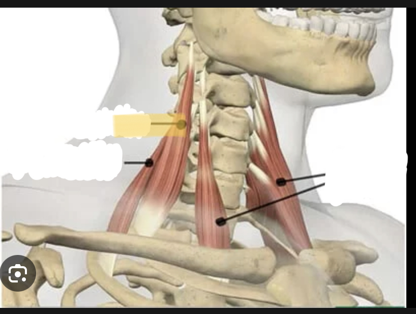 <p>Identify the highlighted muscle</p>