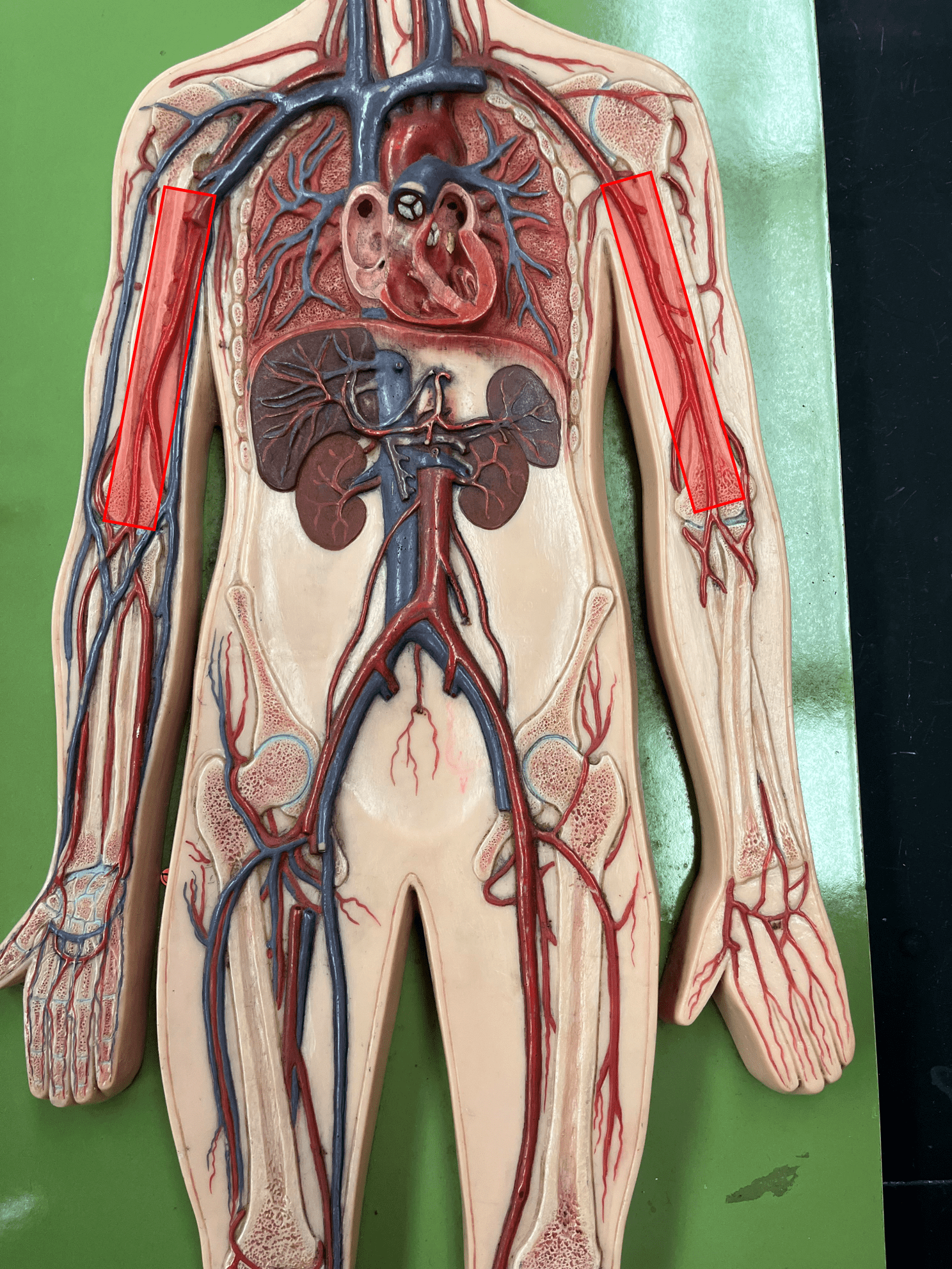 <p>• An artery of the upper limb.</p>
<p>• Originates as the continuation of the axillary artery.</p>
<p>• Supplies the anterior muscles of the upper arm.</p>