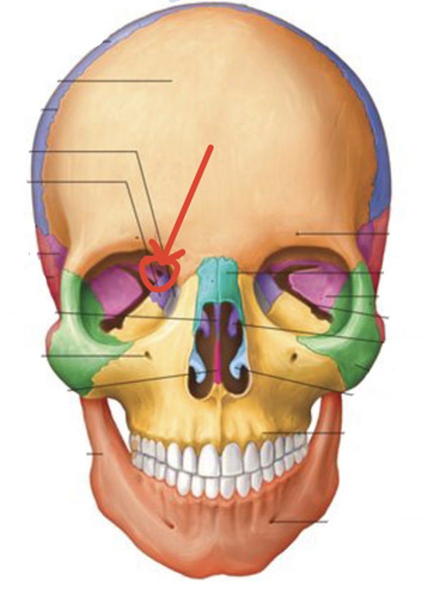 <p>Identify this structure:</p>