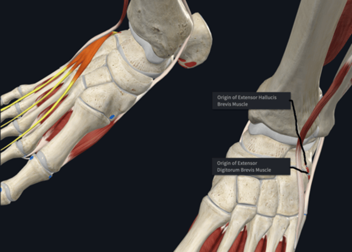 <p>Origin: extensor digitorum brevis</p>