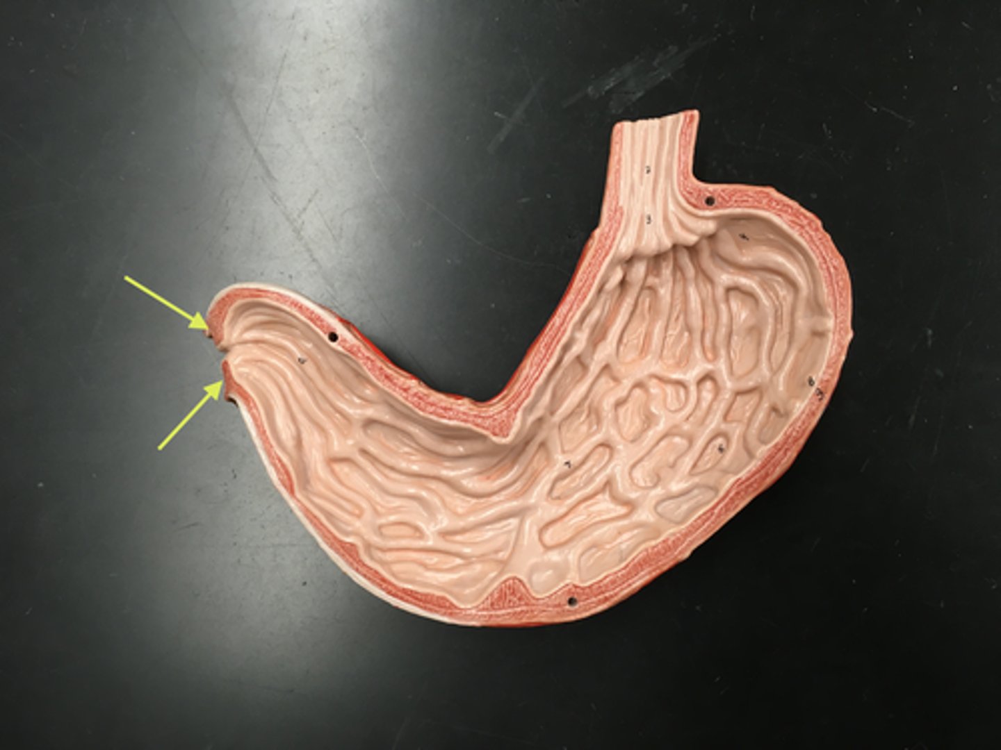 <p>Name this structure</p>