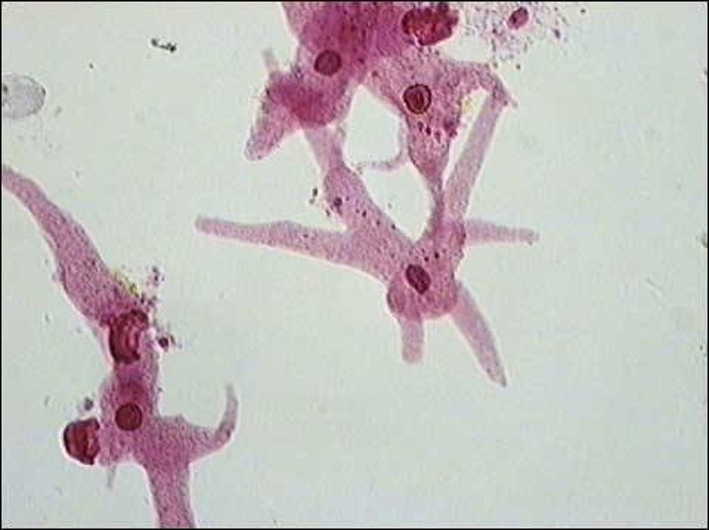 <p>Pseudopodia, amorphous</p><p>Protozoa - Amoebozoa</p>