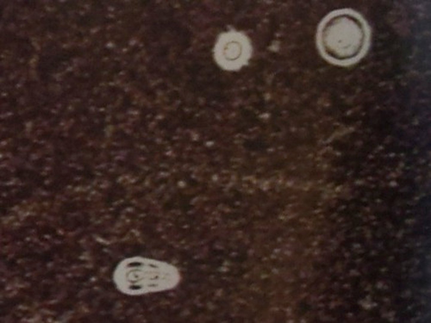<p>- CSF on slide</p><p>- add ink, then coverslip</p><p>- 10x, then 40x</p><p>- detect capsule "halo"</p>