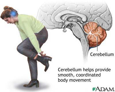 <p>What is the Cerebellum?</p>