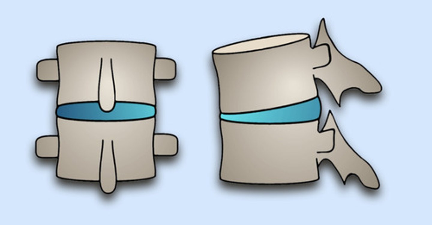 <p>Static listing</p>