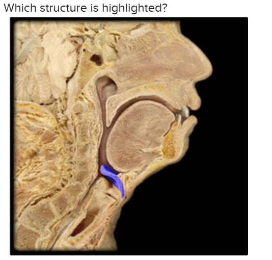 <p>The structure highlighted is: </p>