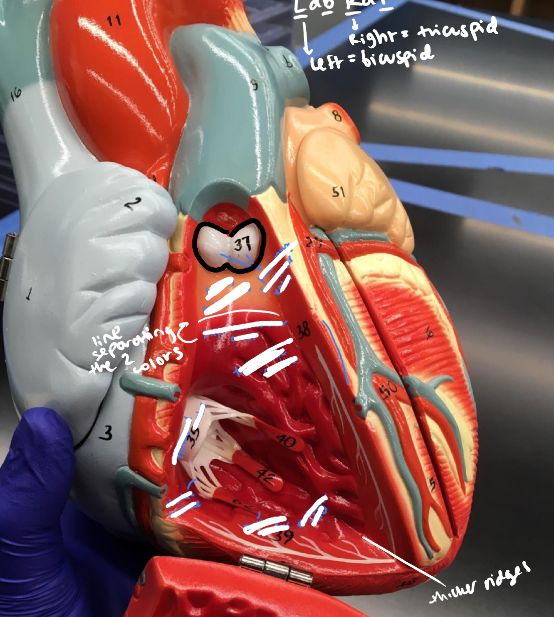 <p>The white butt in the right ventricle</p>