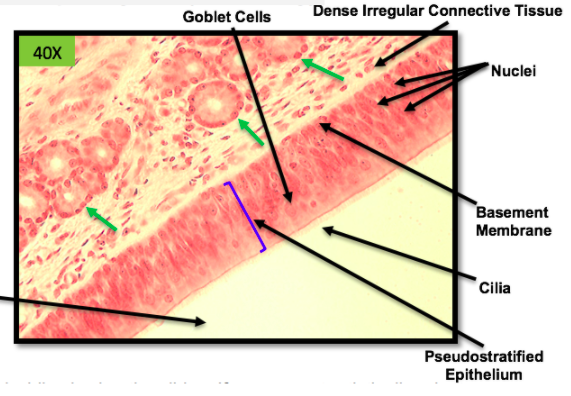 * cillia 
* dense irregular connective tissue
