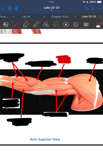 <p>What muscle is this?</p>