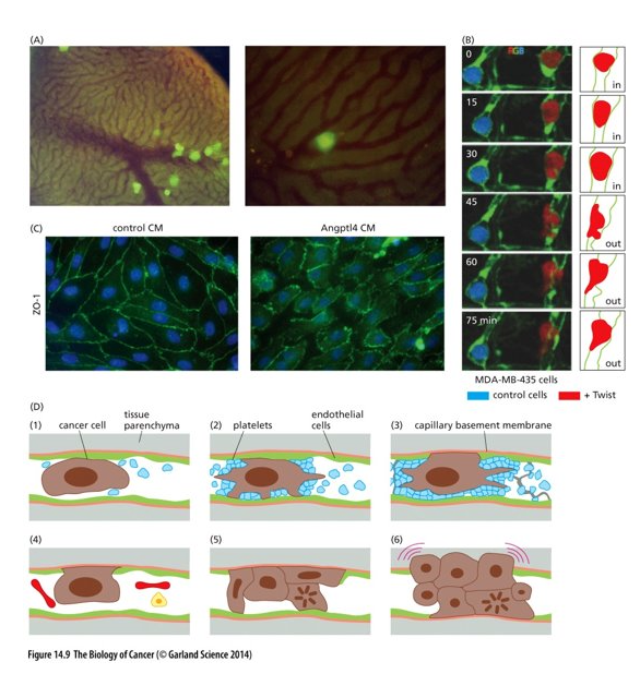 <ul><li><p class="Paragraph WhiteSpaceCollapse SCXP190304477 BCX0" style="text-align: left"><span>Next, cancer cells must exit the blood vessel and enter the surrounding tissue = <strong>extravasation</strong>​</span></p><ul><li><p class="Paragraph WhiteSpaceCollapse SCXP190304477 BCX0" style="text-align: left"><span>Involves complex interactions between the cancer cell and the walls of the vessel​</span></p></li></ul></li><li><p class="Paragraph WhiteSpaceCollapse SCXP190304477 BCX0" style="text-align: left"><span>(A) tumorigenic GFP labelled cells were injected into the portal vein (liver) of a mouse​</span></p></li><li><p class="Paragraph WhiteSpaceCollapse SCXP190304477 BCX0" style="text-align: left"><span>(B) breast cancer cells injected into zebrafish; green = capillary walls​</span></p><ul><li><p class="Paragraph WhiteSpaceCollapse SCXP190304477 BCX0" style="text-align: left"><span>Control cells (blue) unable to cross capillary wall; red cancer cell crosses through​</span></p></li></ul></li><li><p class="Paragraph WhiteSpaceCollapse SCXP190304477 BCX0" style="text-align: left"><span><strong>(C) Angptl4</strong> = angiopoietin-like protein 4 secreted by cancer cells induces endothelial cells to retract from one another and create gaps in the vessel walls (CM = conditioned culture media with Angptl4​</span></p></li><li><p class="Paragraph WhiteSpaceCollapse SCXP190304477 BCX0" style="text-align: left"><span>(D) – cancer cells can proliferate in the blood vessel and create a small tumor that grows and destroys the vessel wall – then able to enter the tissue parenchyma​</span></p></li></ul><p></p>